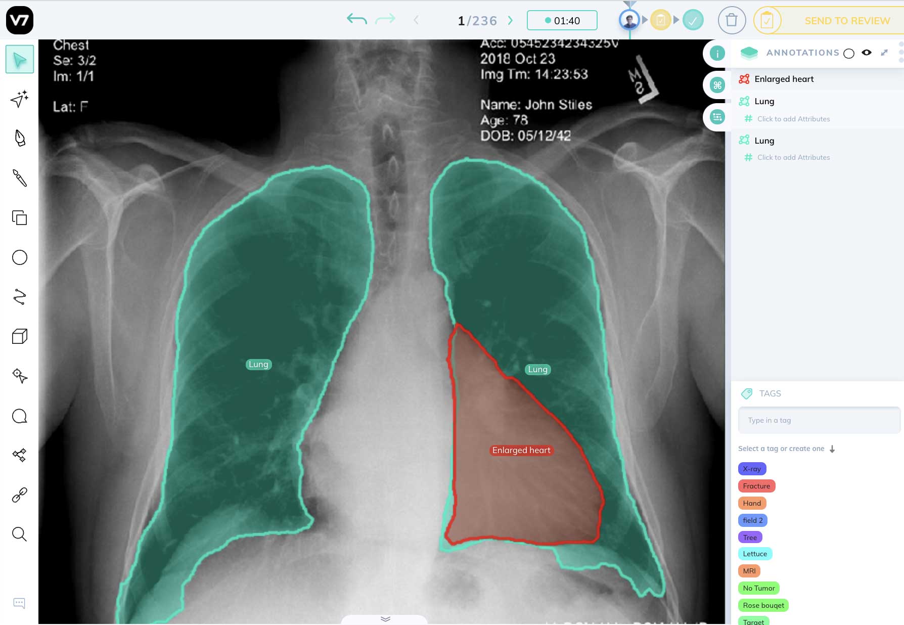 Medical-Imaing-x-ray-chest